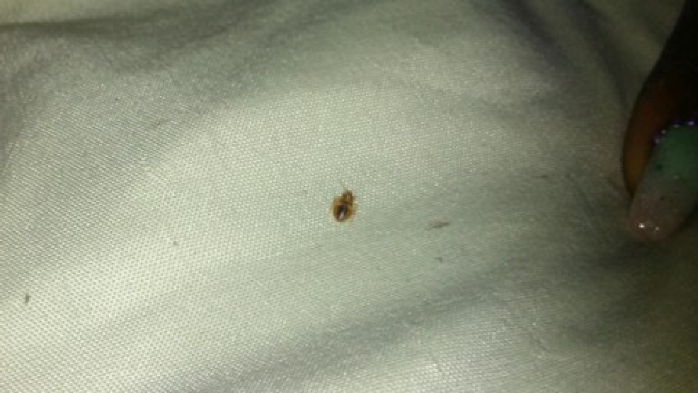 PHOTOS Family of five, local apartment complex feud over bed bug infestation WZTV