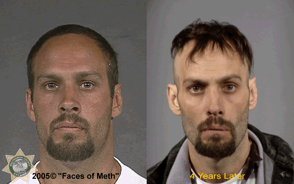 PHOTOS: Before And After Mugshots Of Meth Users | WJLA