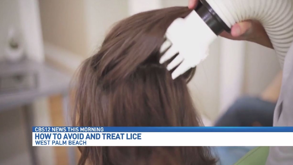 How To Handle Head Lice Wpec