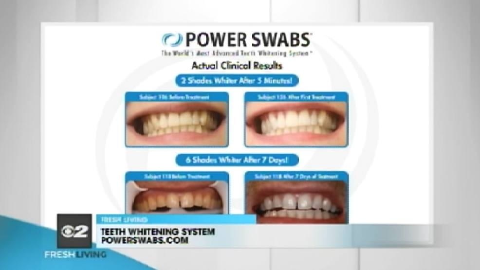 Power Swabs Teeth Whitening System KUTV