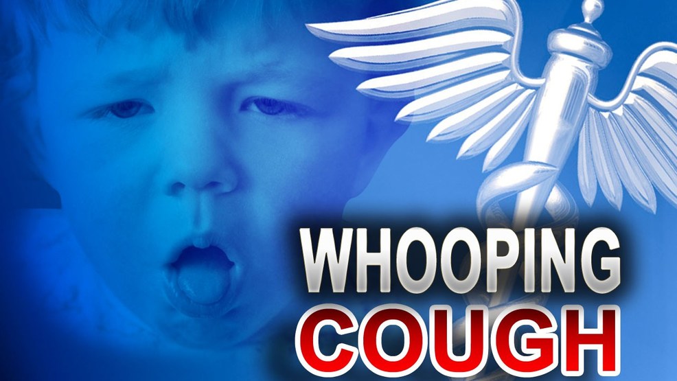 public warning issued about spread of whooping cough in calhoun